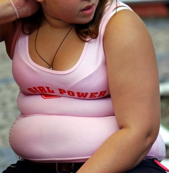 Пандемия ожирения: теперь и в России