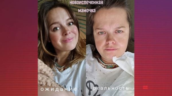 Цена материнства: недавно родившая Медведева показала свою внешность без прикрас